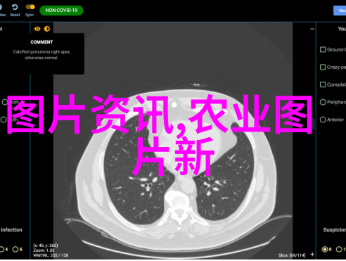 农业种植知识大全如何有效防治最近几年大豆中较为严重的豆荚螟问题